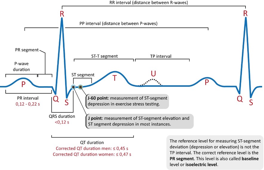 graph of r-r intervals