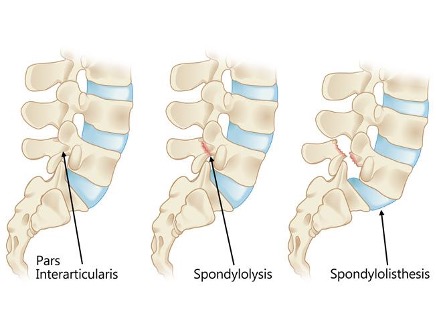 Spine